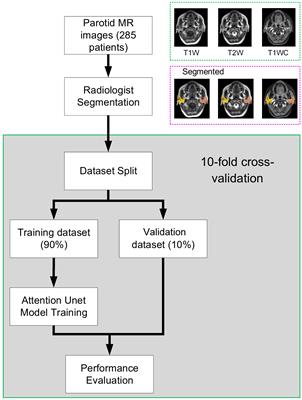 An attention base U-net for parotid tumor autosegmentation